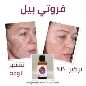 فروتي بيل مقشر احماض الفواكه تقشير الوجه